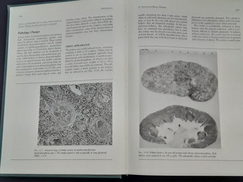 Pathology of the Kidney, Vol. II; Robert H Heptinstall (4th ed -1992) HB 250807 gallery