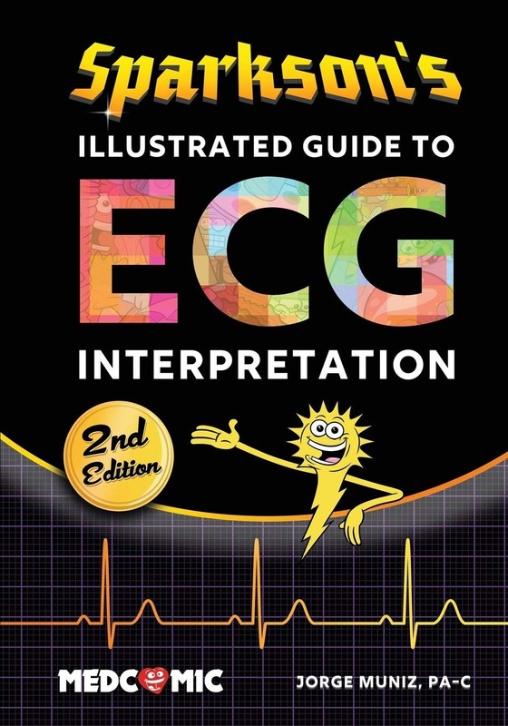 Sparkson's Illustrated Guide to ECG Interpretation, 2nd Edition - paperback ...
