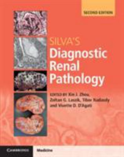 Silva’s Diagnostic Renal Pathology 9781316613986 by Unknown
