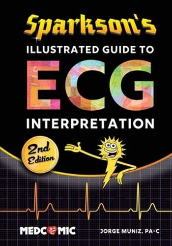 Sparkson's Illustrated Guide to ECG Interpretation, 2nd Edition by Jorge Muniz