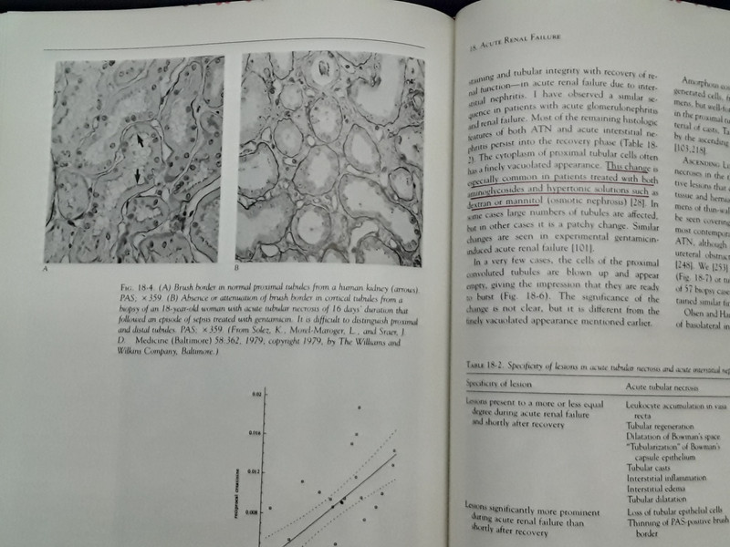 Pathology of the Kidney, Vol. II; Robert H Heptinstall (4th ed -1992) HB 250807 gallery