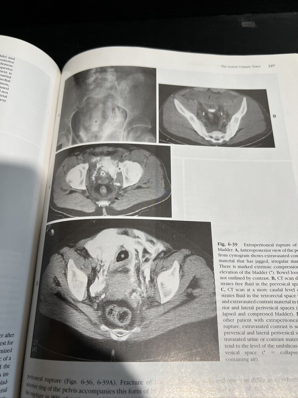 OOP 1st/2nd Genitourinary Radiology by Ronald J. Zagoria & Glenn Tung HC NO DJ gallery