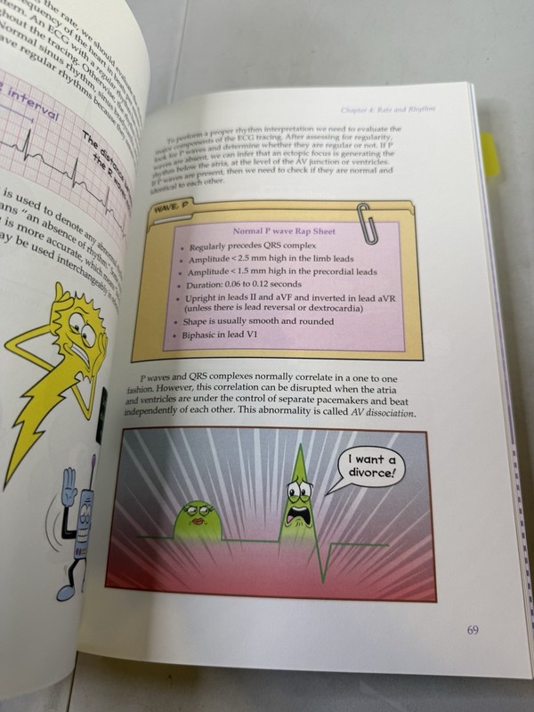 SPARKSON'S ILLUSTRATED GUIDE TO ECG INTERPRETATION By Jorge Muniz gallery