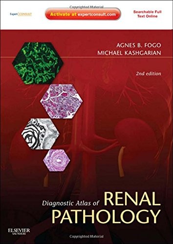 DIAGNOSTIC ATLAS OF RENAL PATHOLOGY: EXPERT CONSULT – By Fogo Agnes B. Md Mint