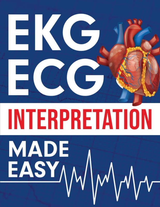 EKG ECG Interpretation Made Easy Paperback by Nedu LLC
